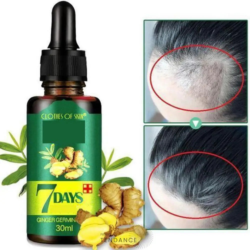 Sérum Naturel Contre La Perte De Cheveux | France-Tendance